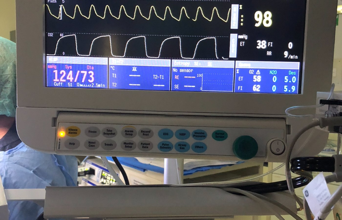 Modern anaesthesia is closely monitored