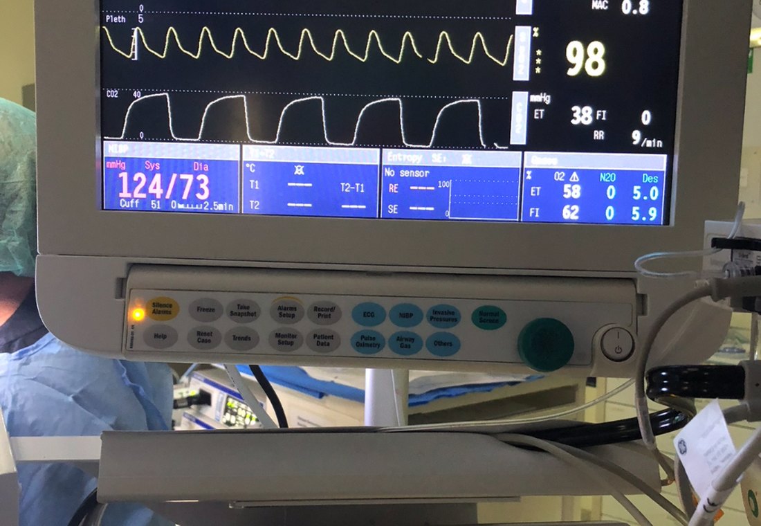 Monitoring screen